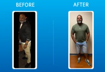 Kirk's before and after